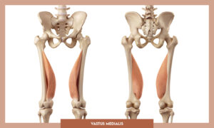 Muscles of thee Lower Limb - Vastus medialis